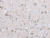 The image on the left is immunohistochemistry of paraffin-embedded Human brain tissue using CSB-PA449302 (TRPM3 Antibody) at dilution 1/20, on the right is treated with synthetic peptide. (Original magnification: ×200)