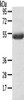 Gel: 8%SDS-PAGE, Lysate: 40 μg, Lane: Mouse plasma tissue, Primary antibody: CSB-PA173647 (AGPAT6 Antibody) at dilution 1/400, Secondary antibody: Goat anti rabbit IgG at 1/8000 dilution, Exposure time: 5 minutes