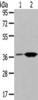 Gel: 8%SDS-PAGE, Lysate: 40 μg, Lane 1-2: Raji cells, Jurkat cells, Primary antibody: CSB-PA550037 (TBXA2R Antibody) at dilution 1/200 dilution, Secondary antibody: Goat anti rabbit IgG at 1/8000 dilution, Exposure time: 40 seconds