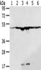 Gel: 8%SDS-PAGE, Lysate: 40 μg, Lane 1-6: A431 cells, SKOV3 cells, 231 cells, Jurkat cells, HepG2 cells, Hela cells, Primary antibody: CSB-PA571464 (DDX39B Antibody) at dilution 1/200 dilution, Secondary antibody: Goat anti rabbit IgG at 1/8000 dilution, Exposure time: 1 second