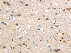 The image on the left is immunohistochemistry of paraffin-embedded Human brain tissue using CSB-PA994474 (HAUS7 Antibody) at dilution 1/30, on the right is treated with synthetic peptide. (Original magnification: ×200)