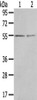 Gel: 8%SDS-PAGE, Lysate: 40 μg, Lane 1-2: 293T cells, Human normal kidney tissue, Primary antibody: CSB-PA584727 (CHRDL1 Antibody) at dilution 1/400 dilution, Secondary antibody: Goat anti rabbit IgG at 1/8000 dilution, Exposure time: 3 minutes