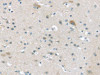 The image on the left is immunohistochemistry of paraffin-embedded Human brain tissue using CSB-PA051160 (VGF Antibody) at dilution 1/45, on the right is treated with synthetic peptide. (Original magnification: ×200)