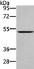 Gel: 8%SDS-PAGE, Lysate: 40 μg, Lane: Mouse lung tissue, Primary antibody: CSB-PA442448 (WASF2 Antibody) at dilution 1/200 dilution, Secondary antibody: Goat anti rabbit IgG at 1/8000 dilution, Exposure time: 1 minute