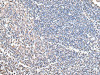 The image on the left is immunohistochemistry of paraffin-embedded Human tonsil tissue using CSB-PA246804 (COX4I1 Antibody) at dilution 1/20, on the right is treated with synthetic peptide. (Original magnification: ×200)