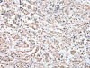 The image on the left is immunohistochemistry of paraffin-embedded Human prostate cancer tissue using CSB-PA246804 (COX4I1 Antibody) at dilution 1/20, on the right is treated with synthetic peptide. (Original magnification: ×200)