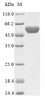 (Tris-Glycine gel) Discontinuous SDS-PAGE (reduced) with 5% enrichment gel and 15% separation gel.