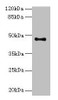 Western blot<br />
 All lanes: AADACL2 antibody at 2µg/ml + PC-3 whole cell lysate<br />
 Secondary<br />
 Goat polyclonal to rabbit IgG at 1/10000 dilution<br />
 Predicted band size: 47, 6 kDa<br />
 Observed band size: 47 kDa<br />
