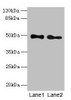 Western blot<br />
 All lanes: ABHD2 antibody at 10µg/ml<br />
 Lane 1: Mouse heart tissue<br />
 Lane 2: Rat gonadal tissue<br />
 Secondary<br />
 Goat polyclonal to rabbit IgG at 1/10000 dilution<br />
 Predicted band size: 49 kDa<br />
 Observed band size: 49 kDa<br />