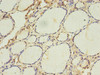 Immunohistochemistry of paraffin-embedded human thyroid tissue using CSB-PA001117LA01HU at dilution of 1:100
