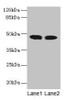 Western blot<br />
 All lanes: ACADL antibody at 8µg/ml<br />
 Lane 1: Mouse kidney tissue<br />
 Lane 2: Mouse heart tissue<br />
 Secondary<br />
 Goat polyclonal to rabbit IgG at 1/10000 dilution<br />
 Predicted band size: 48 kDa<br />
 Observed band size: 48 kDa<br />