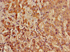 Immunohistochemistry of paraffin-embedded human liver tissue using CSB-PA001125LA01HU at dilution of 1:100