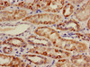 Immunohistochemistry of paraffin-embedded human kidney tissue using CSB-PA001126LA01HU at dilution of 1:100