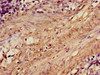 Immunohistochemistry of paraffin-embedded human smooth muscle tissue using CSB-PA001255LA01HU at dilution of 1:100