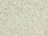 Immunohistochemistry of paraffin-embedded human liver tissue using CSB-PA001560LA01HU at dilution of 1:100