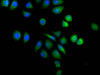 Immunofluorescence staining of A549 cells with CSB-PA001572EA01HU at 1:100, counter-stained with DAPI. The cells were fixed in 4% formaldehyde, permeabilized using 0.2% Triton X-100 and blocked in 10% normal Goat Serum. The cells were then incubated with the antibody overnight at 4°C.The secondary antibody was Alexa Fluor 488-congugated AffiniPure Goat Anti-Rabbit IgG (H+L) .