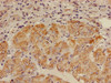 Immunohistochemistry of paraffin-embedded human adrenal gland tissue using CSB-PA001575LA01HU at dilution of 1:100