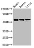 Western Blot<br />
 Positive WB detected in: Rat heart tissue, Rat brain tissue, Mouse liver tissue<br />
 All lanes: ALDH5A1 antibody at 3.2µg/ml<br />
 Secondary<br />
 Goat polyclonal to rabbit IgG at 1/50000 dilution<br />
 Predicted band size: 58, 59 kDa<br />
 Observed band size: 58 kDa<br />