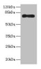 Western blot<br />
 All lanes: ALOX15B antibody at 16µg/ml + HepG2 whole cell lysate<br />
 Secondary<br />
 Goat polyclonal to rabbit IgG at 1/10000 dilution<br />
 Predicted band size: 76, 68, 70, 73 kDa<br />
 Observed band size: 76 kDa<br />