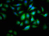 Immunofluorescence staining of A549 cells with CSB-PA001622LA01HU at 1:166, counter-stained with DAPI. The cells were fixed in 4% formaldehyde, permeabilized using 0.2% Triton X-100 and blocked in 10% normal Goat Serum. The cells were then incubated with the antibody overnight at 4°C. The secondary antibody was Alexa Fluor 488-congugated AffiniPure Goat Anti-Rabbit IgG (H+L) .