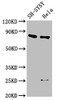 Western Blot<br />
 Positive WB detected in: SH-SY5Y whole cell lysate, Hela whole cell lysate<br />
 All lanes: CTNNB1 antibody at 2.5µg/ml<br />
 Secondary<br />
 Goat polyclonal to rabbit IgG at 1/50000 dilution<br />
 Predicted band size: 86 kDa<br />
 Observed band size: 86 kDa<br />