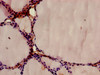 Immunohistochemistry of paraffin-embedded human thyroid tissue using CSB-PA001852LA01HU at dilution of 1:100