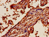 Immunohistochemistry of paraffin-embedded human placenta tissue using CSB-PA001909OJ01HU at dilution of 1:100