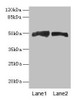 Western blot<br />
 All lanes: AZIN1 antibody at 4µg/ml<br />
 Lane 1: Mouse liver tissue<br />
 Lane 2: PC-3 whole cell lysate<br />
 Secondary<br />
 Goat polyclonal to rabbit IgG at 1/10000 dilution<br />
 Predicted band size: 50 kDa<br />
 Observed band size: 50 kDa<br />