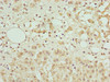 Immunohistochemistry of paraffin-embedded human adrenal gland tissue using CSB-PA002484LA01HU at dilution of 1:100