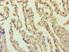 Immunohistochemistry of paraffin-embedded human lung tissue using CSB-PA002608HA01HU at dilution of 1:100