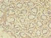 Immunohistochemistry of paraffin-embedded human small intestine tissue using CSB-PA003463LA01HU at dilution of 1:100