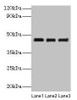 Western blot<br />
 All lanes: SERPINB14 antibody at 2µg/ml<br />
 Lane 1: Ovalbumin at 1: 4000<br />
 Lane 2: Ovalbumin at 1: 8000<br />
 Lane 3: Ovalbumin at 1: 16000<br />
 Secondary<br />
 Goat polyclonal to rabbit IgG at 1/10000 dilution<br />
 Predicted band size: 46 kDa<br />
 Observed band size: 46 kDa<br />
