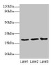 Western blot<br />
 All lanes: Ca1 antibody at 2µg/ml<br />
 Lane 1: Rat spleen tissue<br />
 Lane 2: Rat lung tissue<br />
 Lane 3: Rat kidney tissue<br />
 Secondary<br />
 Goat polyclonal to rabbit IgG at 1/10000 dilution<br />
 Predicted band size: 29 kDa<br />
 Observed band size: 29 kDa<br />