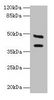 Western blot<br />
 All lanes: CA12 antibody at 6µg/ml + Mouse kidney tissue<br />
 Secondary<br />
 Goat polyclonal to rabbit IgG at 1/10000 dilution<br />
 Predicted band size: 40, 39 kDa<br />
 Observed band size: 40, 48 kDa<br />