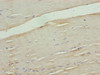 Immunohistochemistry of paraffin-embedded human skeletal muscle tissue using CSB-PA004407LA01HU at dilution of 1:100