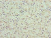 Immunohistochemistry of paraffin-embedded human gastric cancer using CSB-PA004556LA01HU at dilution of 1:100