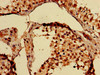 Immunohistochemistry of paraffin-embedded human testis tissue using CSB-PA00465A0Rb at dilution of 1:100