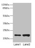 Western blot<br />
 All lanes: CDC42 antibody at 6µg/ml<br />
 Lane 1: Hela whole cell lysate<br />
 Lane 2: Jurkat whole cell lysate<br />
 Secondary<br />
 Goat polyclonal to rabbit IgG at 1/10000 dilution<br />
 Predicted band size: 22 kDa<br />
 Observed band size: 22 kDa<br />