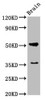 Western Blot<br />
 Positive WB detected in: Rat brain tissue<br />
 All lanes: Chrm1 antibody at 5.5µg/ml<br />
 Secondary<br />
 Goat polyclonal to rabbit IgG at 1/50000 dilution<br />
 Predicted band size: 52 kDa<br />
 Observed band size: 52 kDa<br />