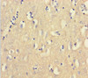 Immunohistochemistry of paraffin-embedded human brain tissue using CSB-PA005637HA01HU at dilution of 1:100