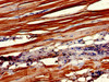 Immunohistochemistry of paraffin-embedded human skeletal muscle tissue using CSB-PA005684EA01HU at dilution of 1:100