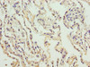 Immunohistochemistry of paraffin-embedded human lung tissue using CSB-PA005743LA01HU at dilution of 1:100