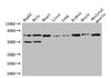 Western Blot<br />
 Positive WB detected in: HepG2 whole cell lysate, Hela whole cell lysate, Mouse heart tissue, Mouse liver tissue, Mouse lung tissue, Mouse kidney tissue, Mouse brain tissue, Mouse skeletal muscle tissue<br />
 All lanes: COL8A1 antibody at 3µg/ml<br />
 Secondary<br />
 Goat polyclonal to rabbit IgG at 1/50000 dilution<br />
 Predicted band size: 74 kDa<br />
 Observed band size: 74 kDa<br />