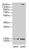 Western blot<br />
 All lanes: CRABP1 antibody at 4µg/ml<br />
 Lane 1: Mouse eye tissue<br />
 Lane 2: THP-1 whole cell lysate<br />
 Secondary<br />
 Goat polyclonal to rabbit IgG at 1/10000 dilution<br />
 Predicted band size: 16 kDa<br />
 Observed band size: 16 kDa<br />