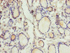 Immunohistochemistry of paraffin-embedded human thyroid tissue using CSB-PA005935DA01HU at dilution of 1:100