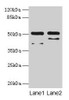 Western blot<br />
 All lanes: CRHR1 antibody at 16µg/ml<br />
 Lane 1: Hela whole cell lysate<br />
 Lane 2: HL60 whole cell lysate<br />
 Secondary<br />
 Goat polyclonal to rabbit IgG at 1/10000 dilution<br />
 Predicted band size: 51, 48, 44, 47, 29 kDa<br />
 Observed band size: 51 kDa<br />