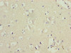 Immunohistochemistry of paraffin-embedded human brain tissue using CSB-PA005965EA01HU at dilution of 1:100