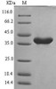 (Tris-Glycine gel) Discontinuous SDS-PAGE (reduced) with 5% enrichment gel and 15% separation gel.