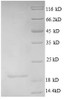 (Tris-Glycine gel) Discontinuous SDS-PAGE (reduced) with 5% enrichment gel and 15% separation gel.