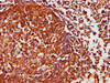 IHC image of CSB-PA006067LA01HU diluted at 1:1000 and staining in paraffin-embedded human lymph node tissue performed on a Leica BondTM system. After dewaxing and hydration, antigen retrieval was mediated by high pressure in a citrate buffer (pH 6.0) . Section was blocked with 10% normal goat serum 30min at RT. Then primary antibody (1% BSA) was incubated at 4°C overnight. The primary is detected by a biotinylated secondary antibody and visualized using an HRP conjugated SP system.